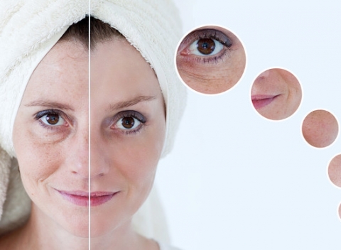 Zobudiť sa znova mladá? Áno! Dermabotexín – botulotoxín intenzívna starostlivosť proti vráskam alebo ultrazvukový lifting tváre. 