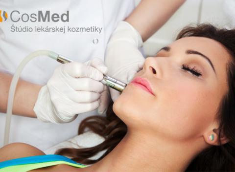 Dokonale hladká pokožka vďaka frakčnému laseru, Čas sa síce vrátiť nedá, no vďaka tomuto ošetreniu budete mať o pár rokov menej.