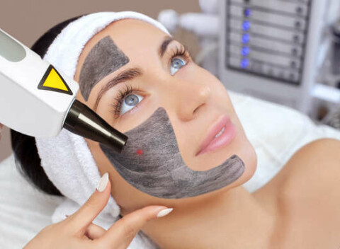 Carbon Laser Peel (Hollywood Peel) pre zjednotenie pleti, stiahnutie pórov a tvorbu vlastného kolagénu.