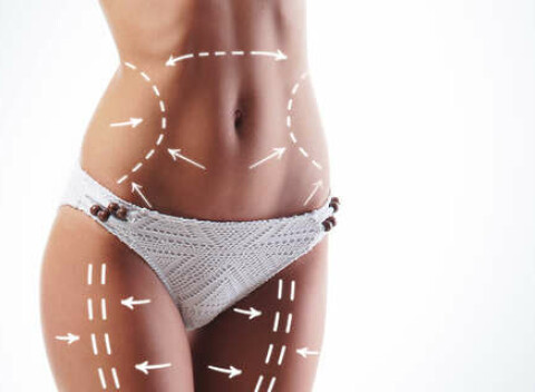 Kavitácia pre tvarovanie postavy alebo lipolaser pre okamžité zoštíhlenie.