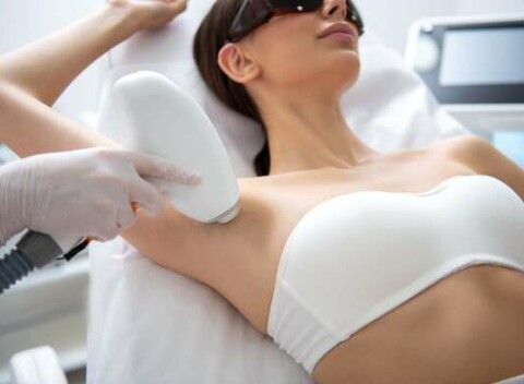 IPL – laserová epilácia na postupné odstránenie ochlpenia s trvalým efektom.