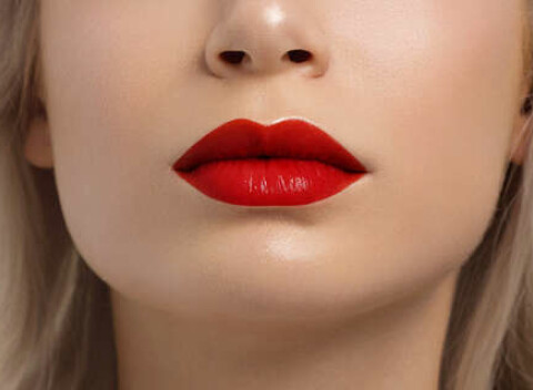 Výplň pier technikou Russian lips kyselinou hyalurónovou alebo odstránenie vrások.