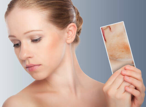 Odstránenie červených žiliek na tvári alebo na tele v Beauty Esthetic Centrum.