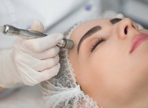 Diamantová mikrodermabrázia - účinná a bezpečná procedúra na omladenie tváre + ozonizér.