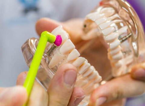 Profesionálna dentálna hygiena s pieskovaním v Starom Meste.