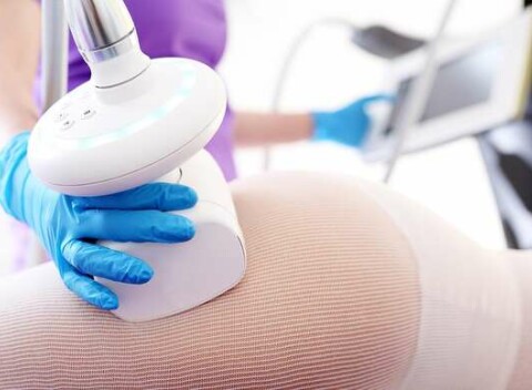 Schudnite bezbolestne s prémiovou liposukciou Ulthera SLIM a komplexné ošetrenie.