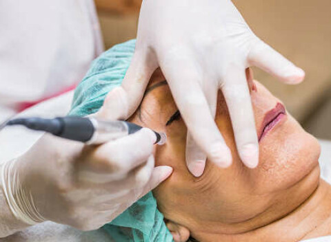 Mezoterapia pre krásnu tvár bez vrások, jazvičiek a pigmentových škvŕn