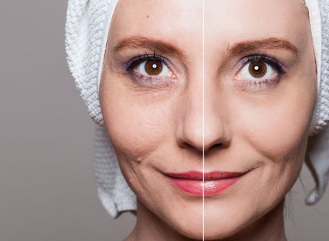 Zbavte sa ochabnutej pleti a získajte dokonalejší tvar tváre. Na výber z 5 kozmetických procedúr.