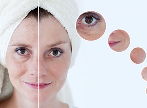 Dermabotexín – botulotoxín intenzívna starostlivosť proti vráskam alebo ultrazvukový lifting tváre.