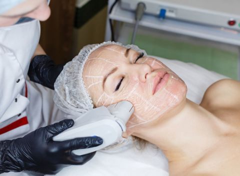 Ultherapia Hifu podľa výberu jednotlivej partie - facelifting bez skalpela.