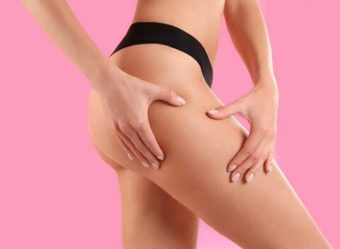 Exkluzívne anticelulitídne ošetrenie v štyroch fázach s luxusnou kozmetikou na klinike Mishellbeauty