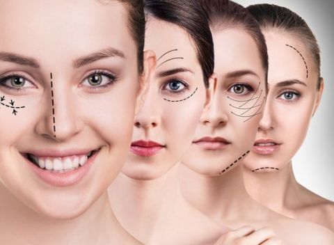 Lifting tváre revolučnou metódou SMAS - výsledok porovnateľný s chirurgickým zákrokom.