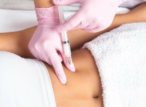 2+1 zadarmo: Lipolýza - lokálne odstránenie tuku z brucha, vnútorných stehien alebo brady