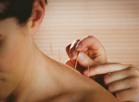 Akupunktúra a ošetrenie pubertálnej pleti v žilinskom Štúdiu BUBEMA