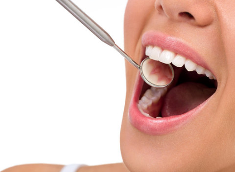 Komplexná dentálna hygiena s fluoridáciou v dentálnom centre Verona.