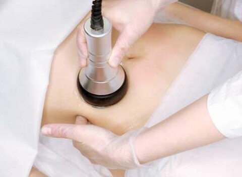 Ultrazvuková liposukcia - kavitácia: bezbolestné formovanie postavy v štúdiu Vibe35