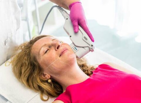 Hifu SMAS ultherapia – neinvazívny facelifting čela, očného okolia, líc, krku, podbradku aj celej tváre