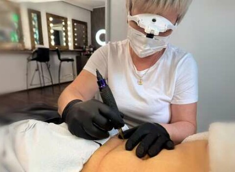 Odstránenie strií a jaziev vďaka mikroneedlingu od Mary Mats Beauty