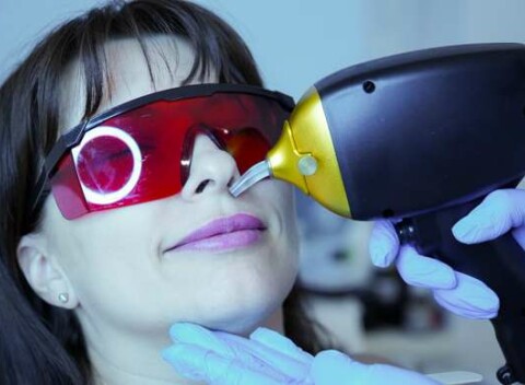 Moderná laserová technológia pre dlhodobé odstránenie nežiadúcich chĺpkov na tvári aj tele v salóne By.kvartiuk