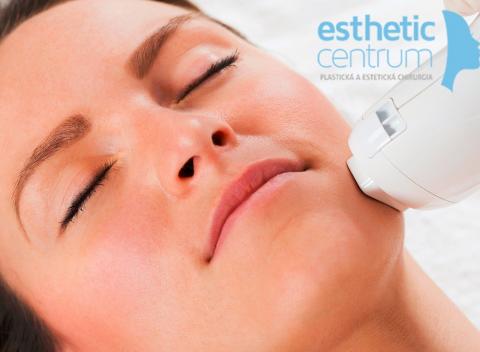 Kvalitná laserová epilácia Zbavte sa zbytočných a neestetických chĺpkov