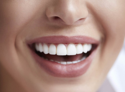 Bielenie zubov esenciou z prírodných látok v JEIN štúdio Bratislava.