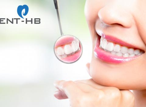 Profesionálna dentálna hygiena pre krásny a zdravý chrup. Najlepšia prevencia vzniku zubného kazua ochorení parodontu.