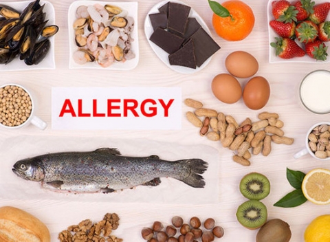 Testovanie potravinových intolerancií a alergénov alebo komplexná biorezonančná diagnostika. Diagnostika, ktorá telo vyšetrí a zharmonizuje.