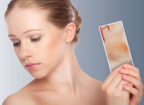 Odstránenie červených žiliek na tvári alebo na tele v Beauty Esthetic Centrum.