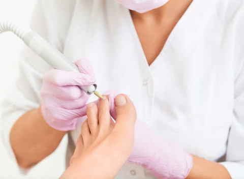 Kombinovaná medicínska pedikúra s odstránením kurích ôk, mykóz či ošetrenie nechtovej platničky.